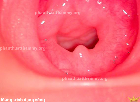 mang-trinh-dang-vong